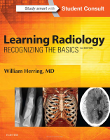 Learning_Radiology_Recognizing_3rd_Edition_2016_PDF_William_Herring.pdf